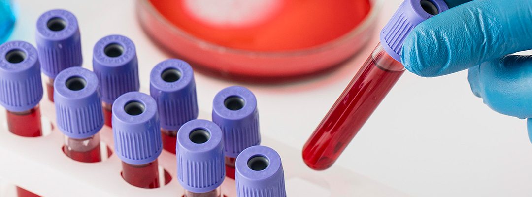 ¡Contamos con nueva especialidad! Hemato-Oncología