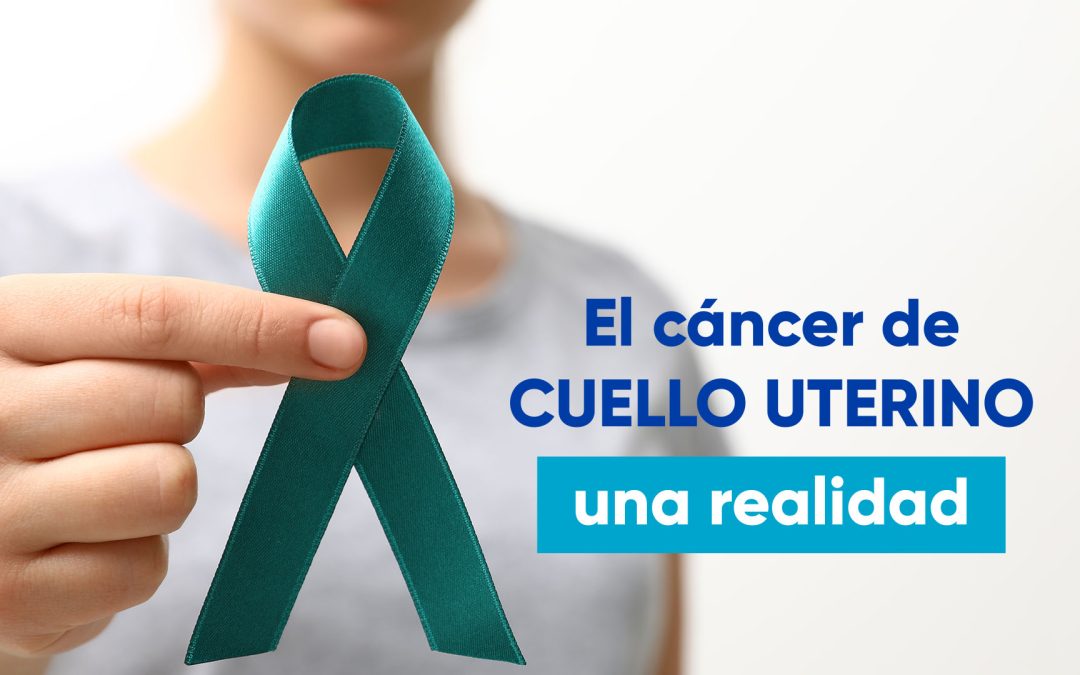 Cómo prevenir el cáncer de cuello uterino: Vacunación, detección y tratamiento